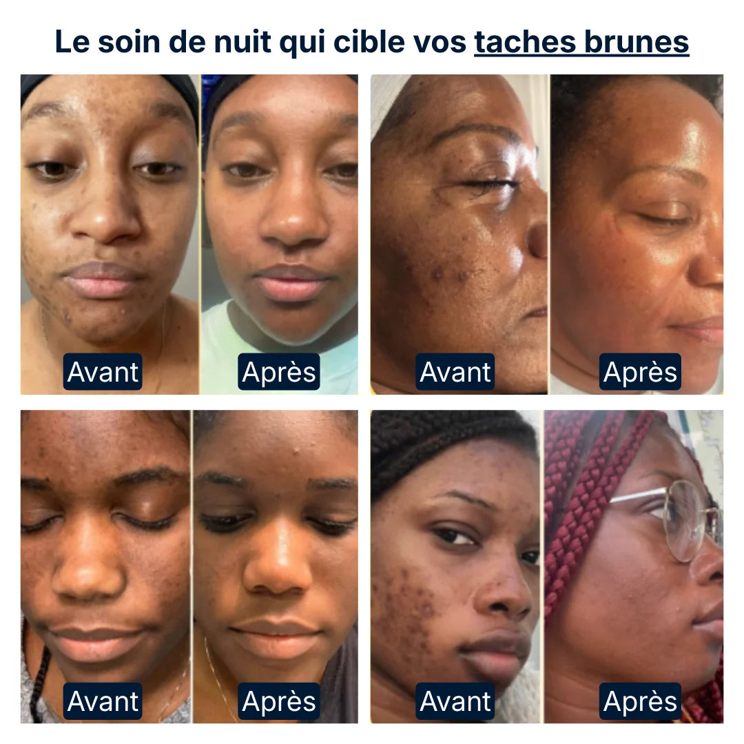 Masque de Nuit Curcuma & Kojic